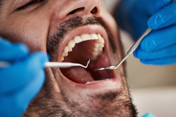Best Weekend Emergency Dentist in Ferrum, VA