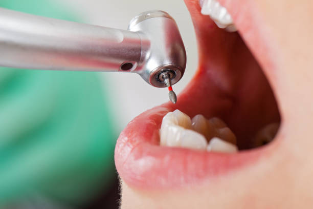 Best Orthodontic Emergency Dentist in Ferrum, VA